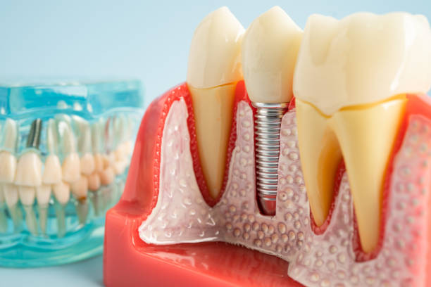 Professional Dental Services in Indianapolis, IN